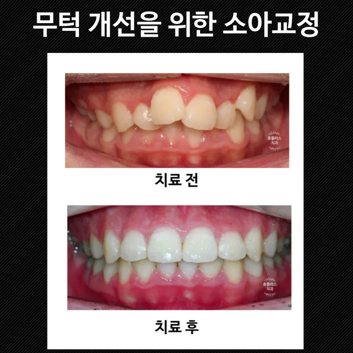 휴플러스치과의원 사진 2