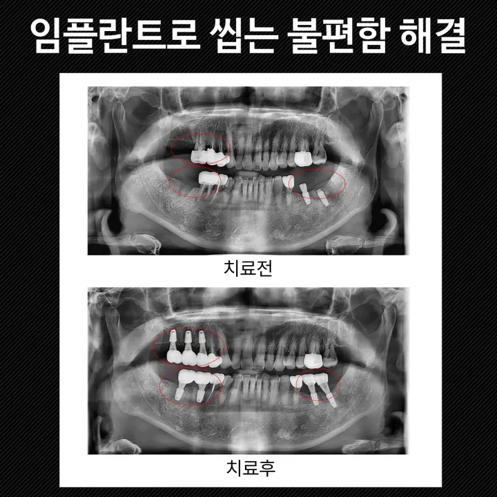 휴플러스치과의원 사진 3