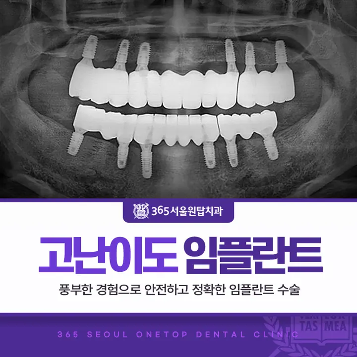 365서울원탑치과의원 — 병원이 네이버 플레이스에 올린 사진