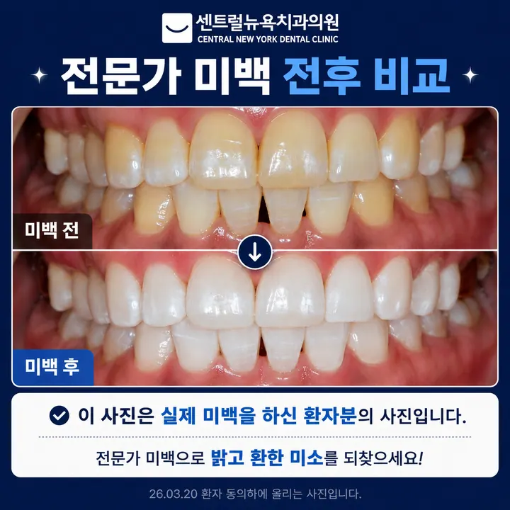 센트럴뉴욕치과의원 — 병원이 네이버 플레이스에 올린 사진