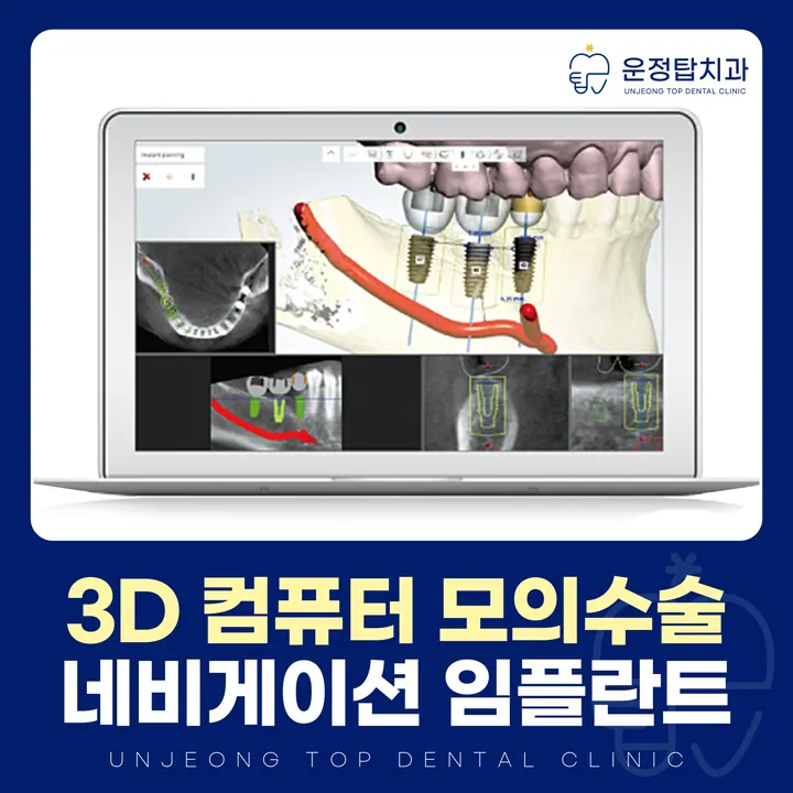 운정탑치과의원 写真 2
