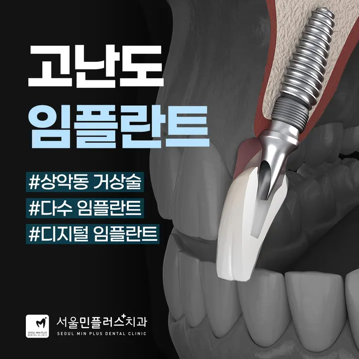 서울민플러스치과의원 — 병원이 네이버 플레이스에 올린 사진