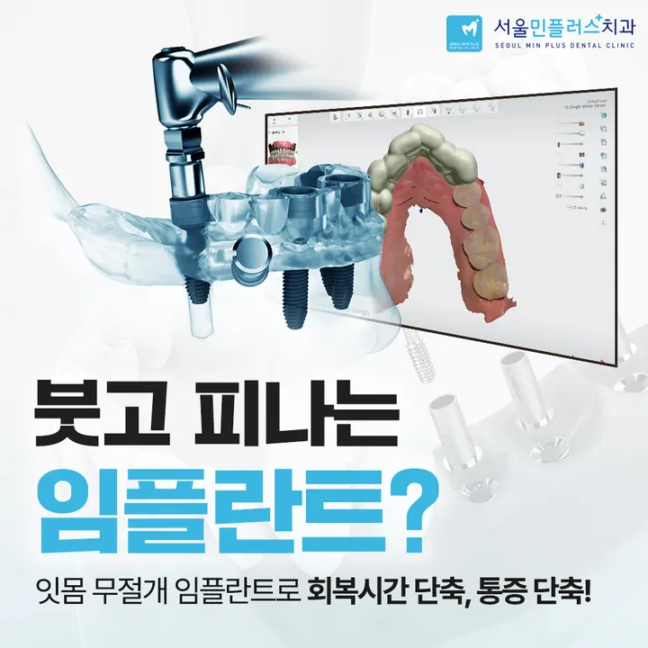 서울민플러스치과의원 사진 2