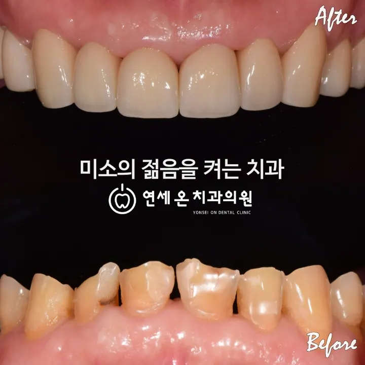 연세온치과의원 — 병원이 네이버 플레이스에 올린 사진