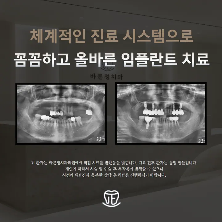 바른정치과의원 — 병원이 네이버 플레이스에 올린 사진
