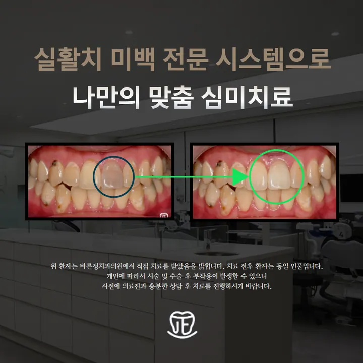 바른정치과의원 사진 3