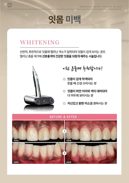 삼성스마트치과의원 사진 3