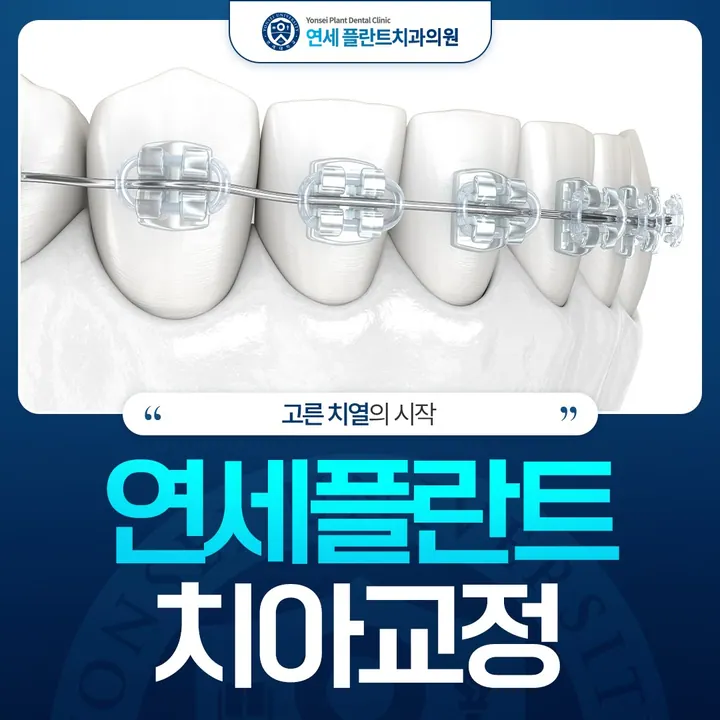 연세플란트치과의원 사진 3