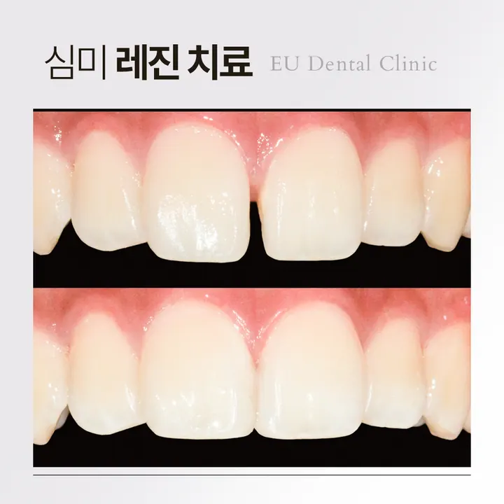 이유치과의원 — 병원이 네이버 플레이스에 올린 사진
