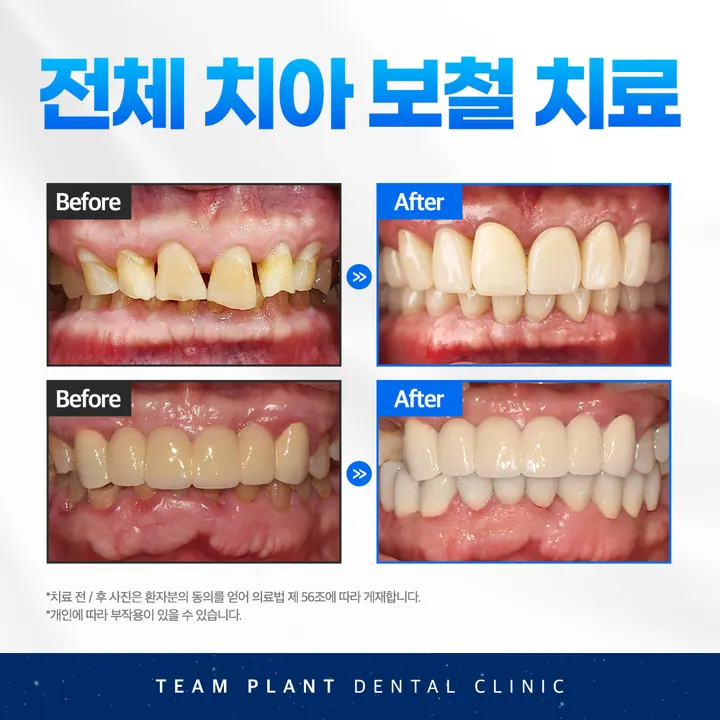 팀플란트치과의원 사진 2