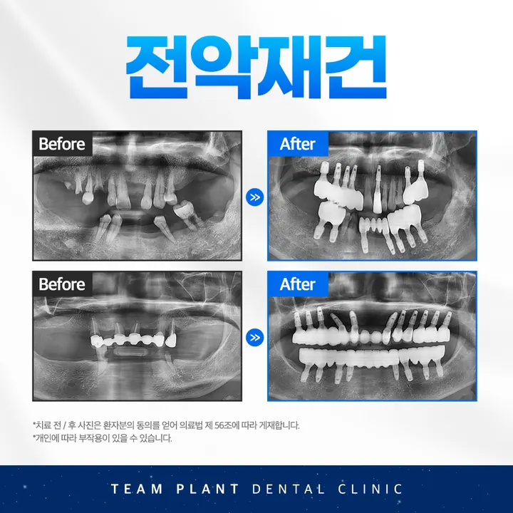 팀플란트치과의원 사진 3