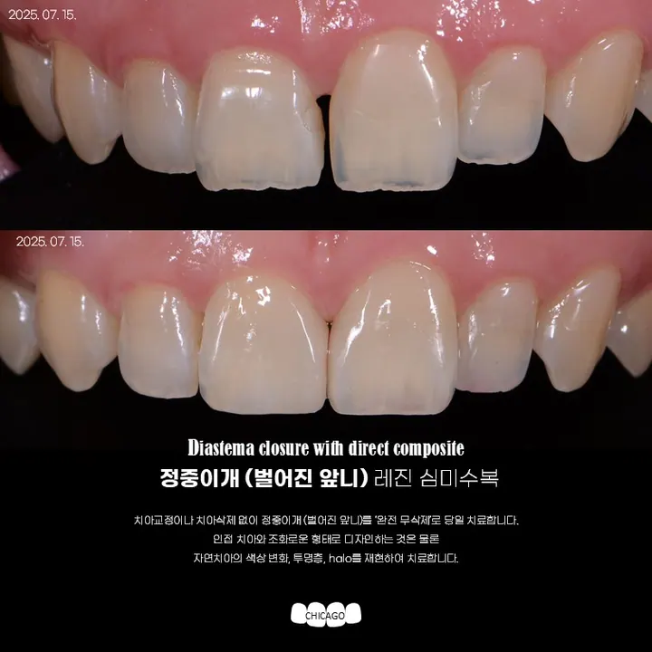 유앤아이시카고치과의원 — 병원이 네이버 플레이스에 올린 사진