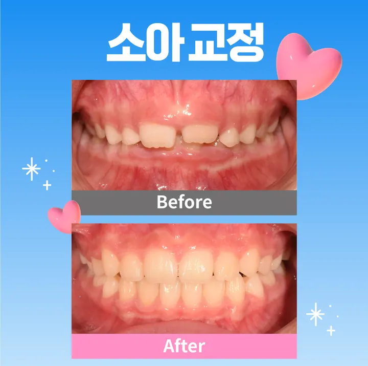 프라임에스치과교정과치과의원 — 병원이 네이버 플레이스에 올린 사진