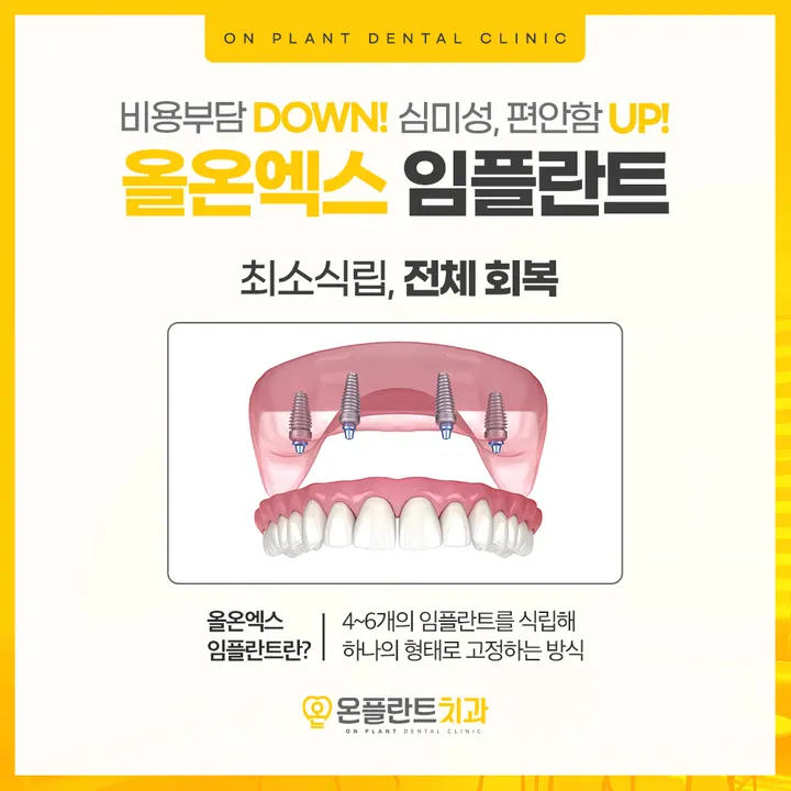 온플란트치과의원 — 병원이 네이버 플레이스에 올린 사진