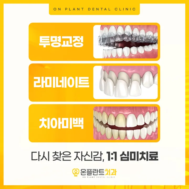 온플란트치과의원 사진 3