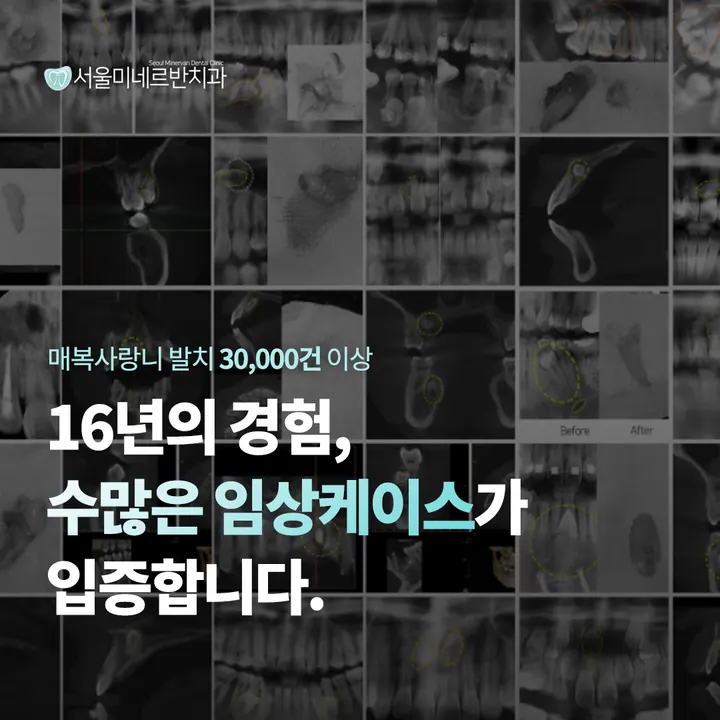 서울미네르반치과의원 — 병원이 네이버 플레이스에 올린 사진