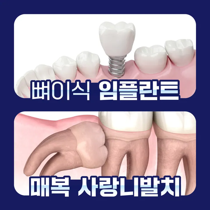서울J플란트치과의원 — 병원이 네이버 플레이스에 올린 사진