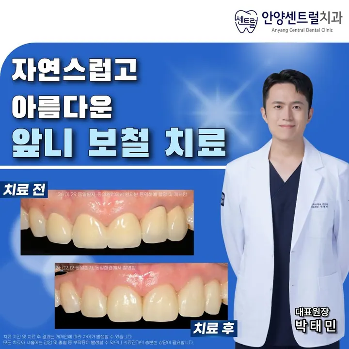 안양센트럴치과의원 — 병원이 네이버 플레이스에 올린 사진
