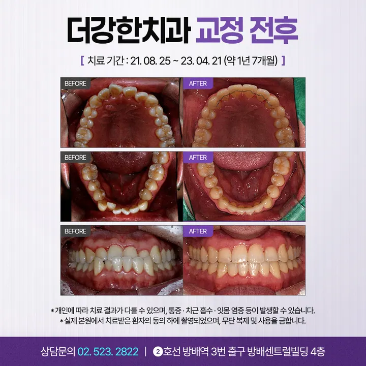 더강한치과의원 사진 2