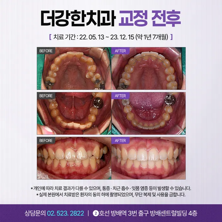 더강한치과의원 사진 3
