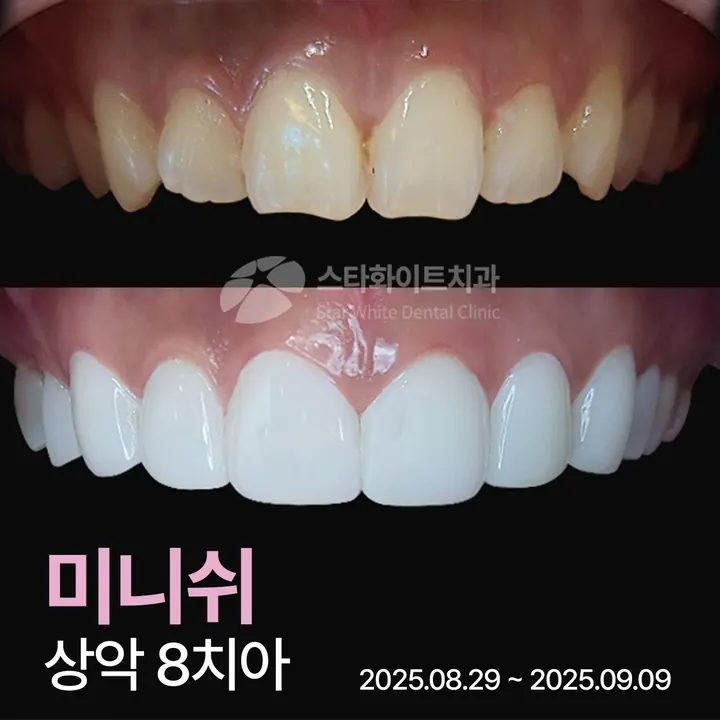 스타화이트치과의원 사진 3